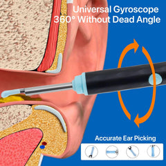 Rechargeable Smart Wireless Ear Camera Kit | Visual Ear Wax Removal Tool With Mobile Display | Random Colour